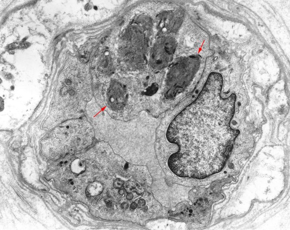 1B9 Fabry's Dz - Copy copy