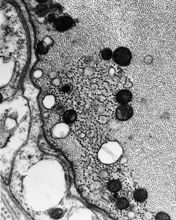 2B5 (Case 2) - CopyB