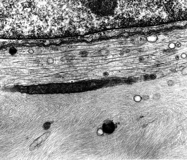 2B6 (Case 2)  - Copy