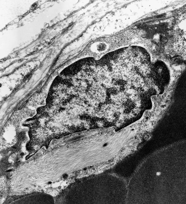 2B8 (Case 2)  - Copy