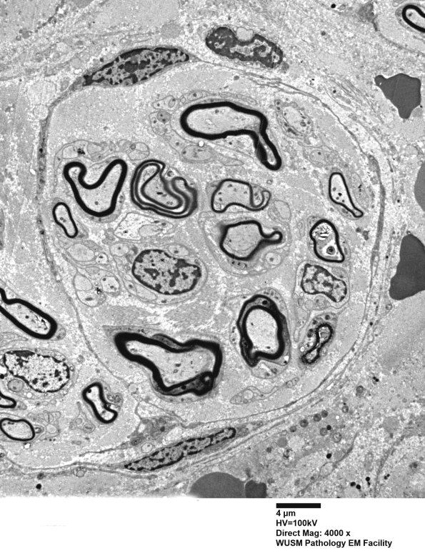 12D1 (Case 12) C5 N root_025 - Copy