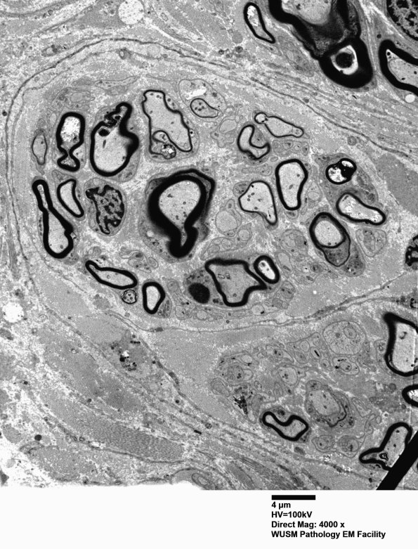 12D2 (Case 12) C5 N root_016 - Copy