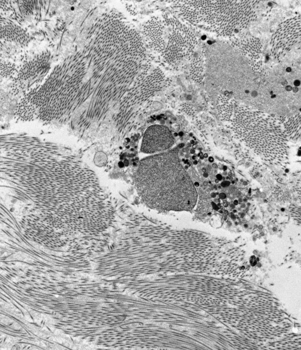 12E1 (Case 12) C5 N root_004 - Copy