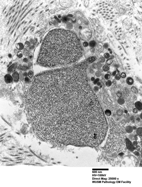 12E2 (Case 12) C5 N root_003 - Copy