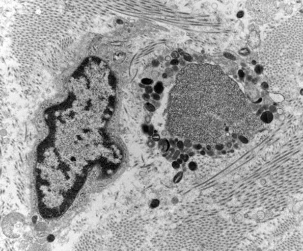 12E3 (Case 12) C5 N root_008a - Copy