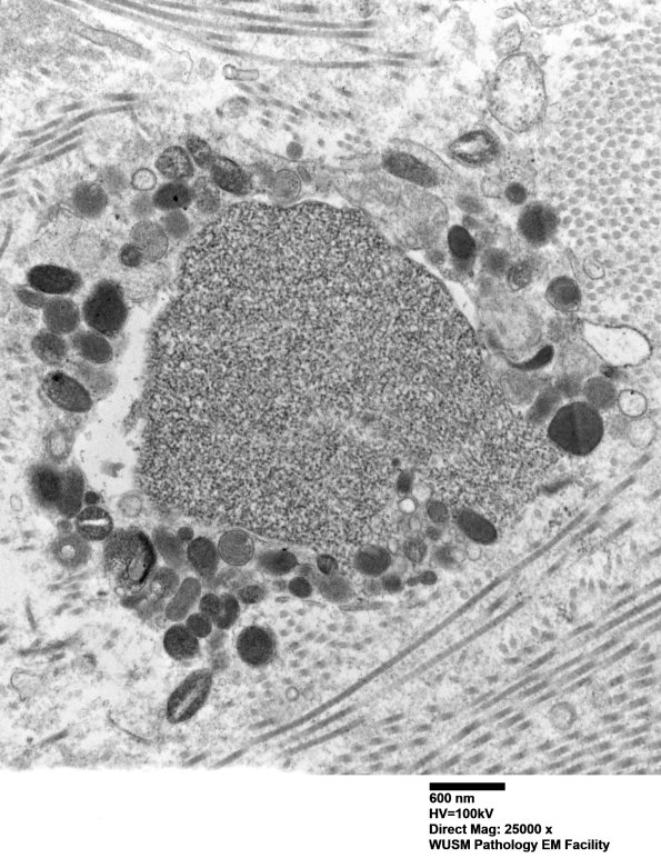 12E4 (Case 12) C5 N root_007 - Copy