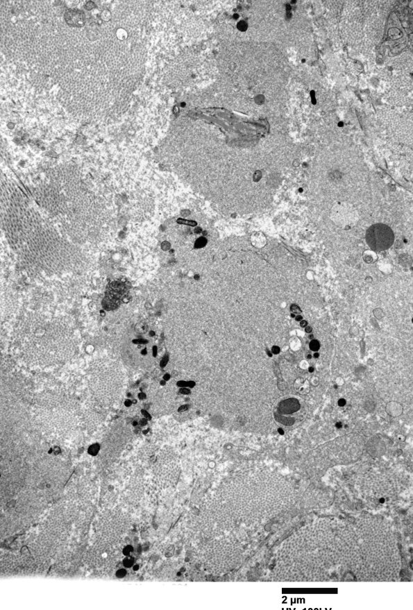 12E5 (Case 12) C5 N root_021 - Copy