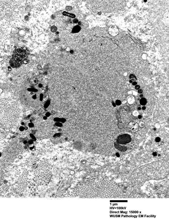 12E6 (Case 12) C5 N root_019 - Copy