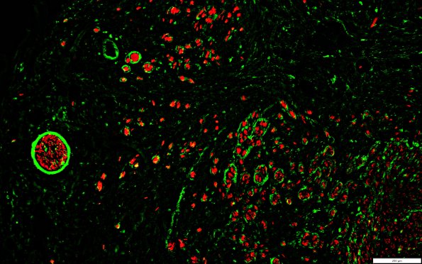 12F1 (Case 12) EMA(g) & P0(r)