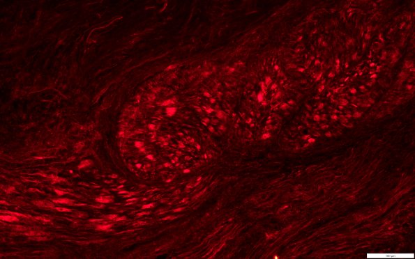 12G3 (Case 12) & GAP43(r) 