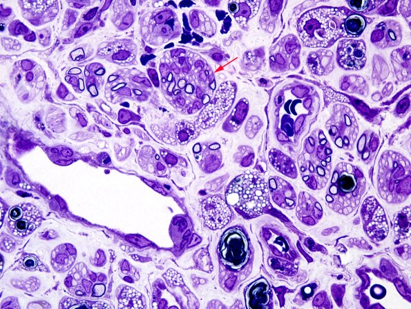 19B1 Trauma (Case 19) Plastic 8 copy.jpg