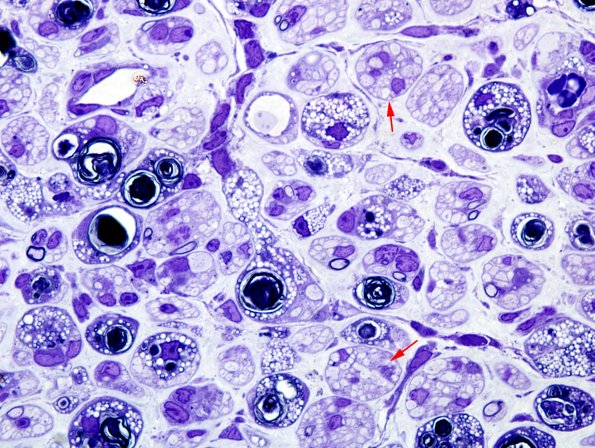 19B2 Trauma (Case 19) Plastic 9 copy.jpg