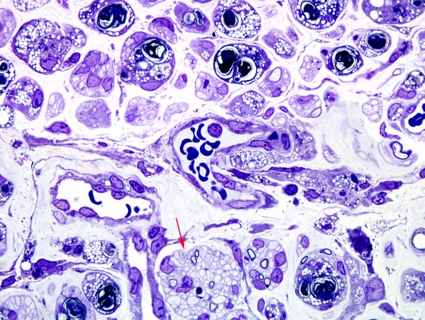 19B3 Trauma (Case 19) Plastic 21 copy.jpg