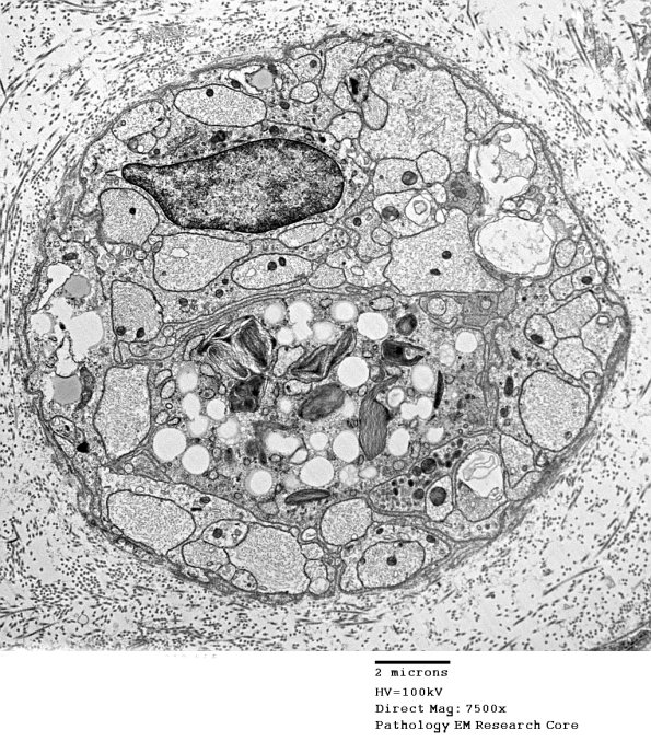 19C1 Trauma (Case 19) EM 012 - Copy
