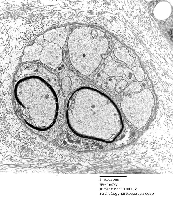 19C2 Trauma (Case 19) EM 017 - Copy