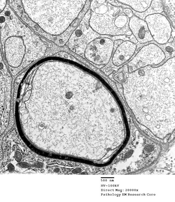 19C3 Trauma (Case 19) EM 018 - Copy