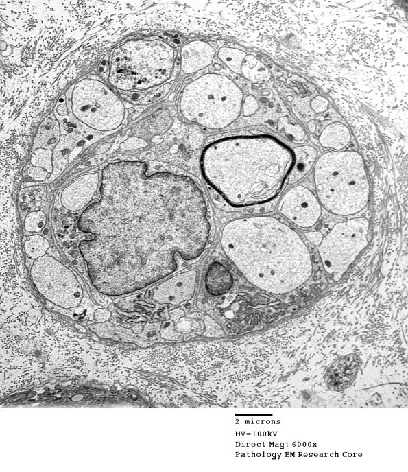 19C4 Trauma (Case 19) EM 019 - Copy