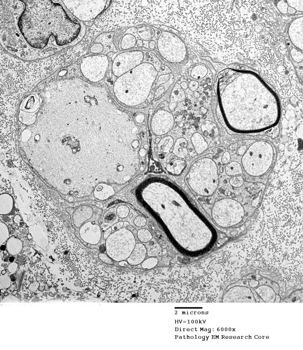 19C6 Trauma (Case 19) EM 039 - Copy