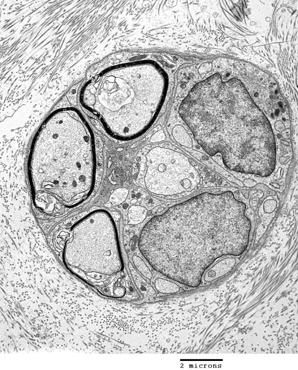 19C7 Trauma (Case 19) EM 022 - Copy