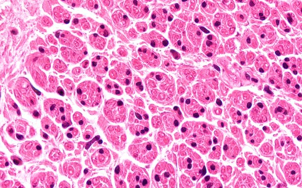 20A3 Suprascapular nerve (Case 20) H&EBlkB 100X 1