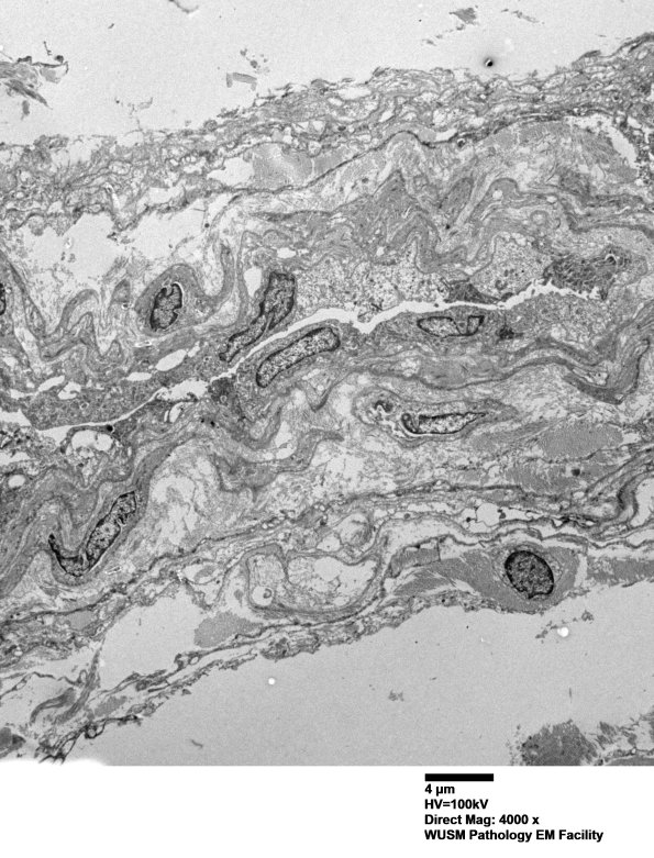 25J1 S97-14797_001A - Copy