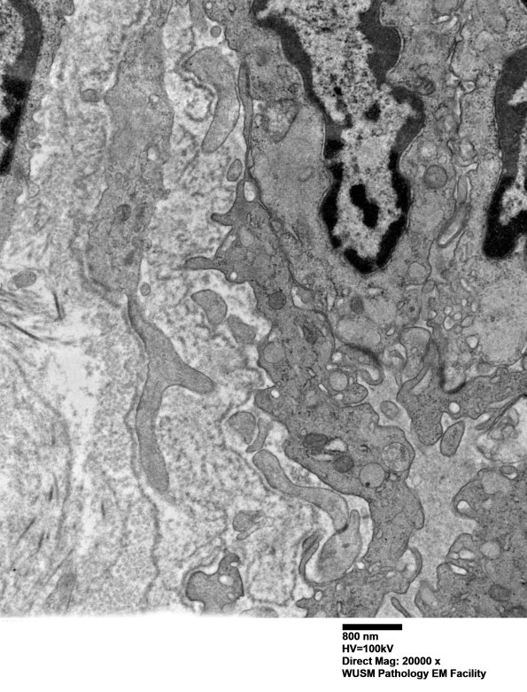 26L4B (Case 26) Ulnar Nerve_084 - Copy