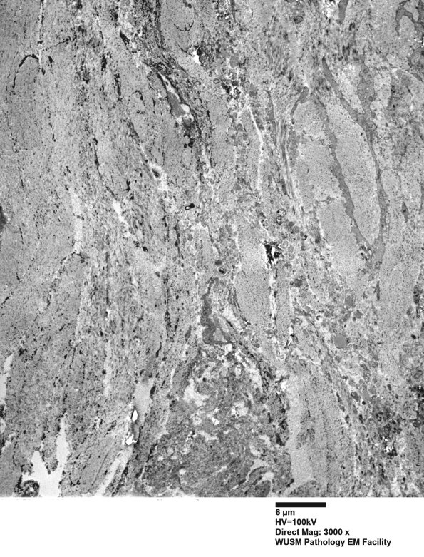 26M4 (Case 26) Ulnar Nerve_088 - Copy