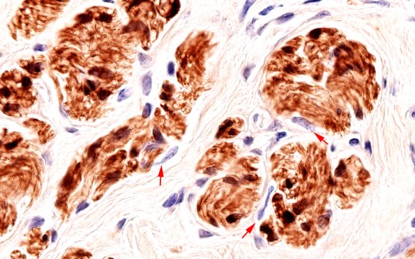 2B3 EMA vs S100 (Case 2) S100 100X 1 copy