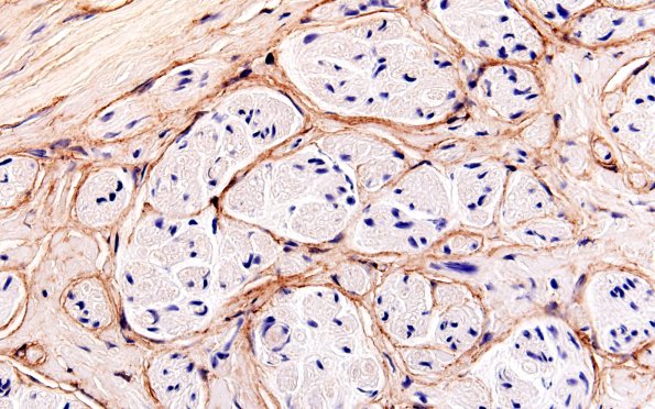 2C2 EMA vs S100 (Case 2) EMA 60X