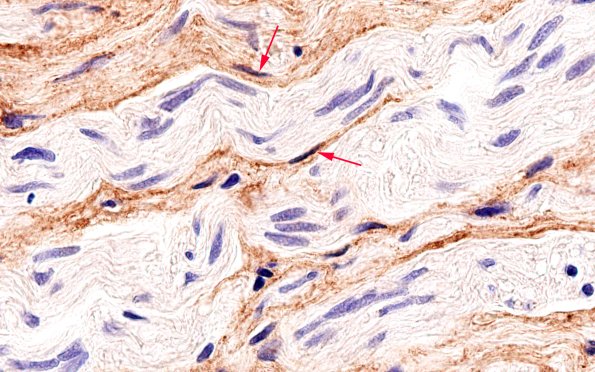 2C3 EMA vs S100 (Case 2) EMA 100X 4 copy