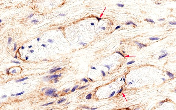 2C4 EMA vs S100 (Case 2) EMA 100X 5 best copy