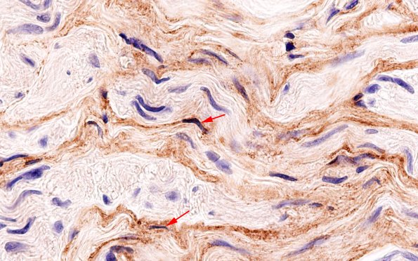 2C5 EMA vs S100 (Case 2) EMA 100X 6 copy