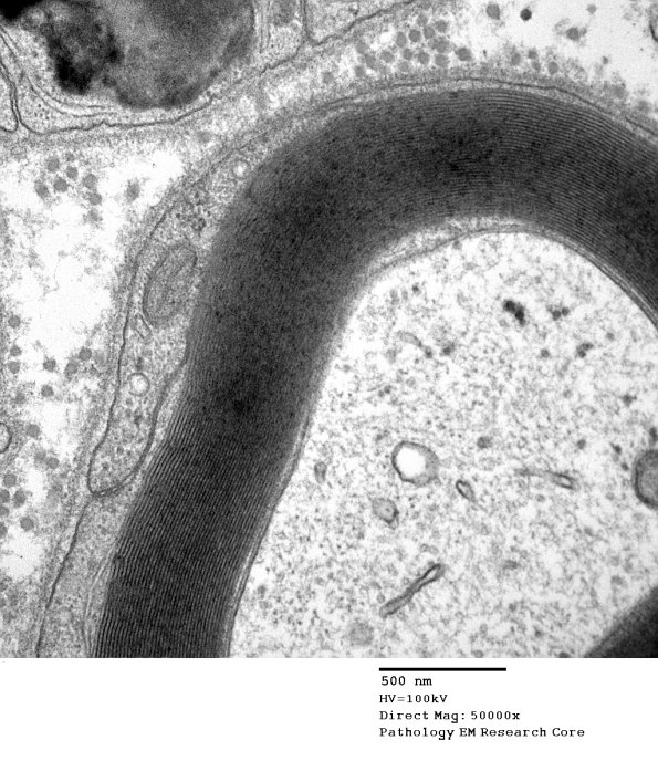 10A2 Axon normal (Case 10) EM 052 - Copy