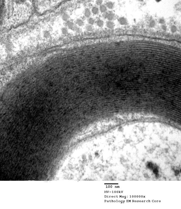 10A4 Axon normal (Case 10) EM 054 (2) - Copy