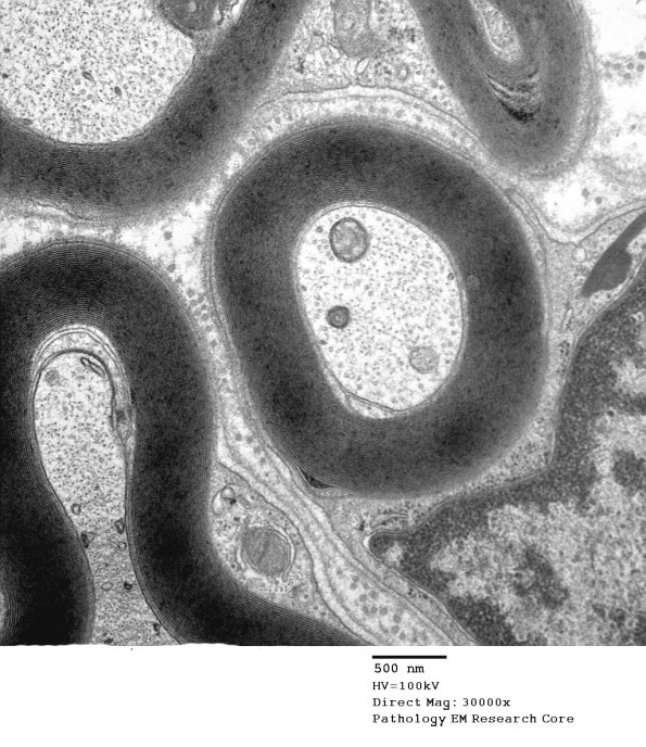 10A5 Axon normal (Case 10) M 067 - Copy