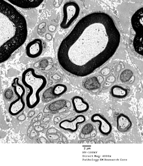 1A3 Normal Nerve (Case 1) new_028A - Copy