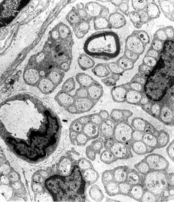 2A 1EM 19 - (Case 2) Copy