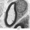 4A1 Normal axon (Case 4) 61 - Copy
