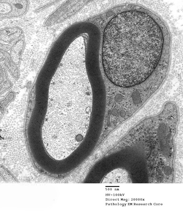4A1 Normal axon (Case 4) 61 - Copy