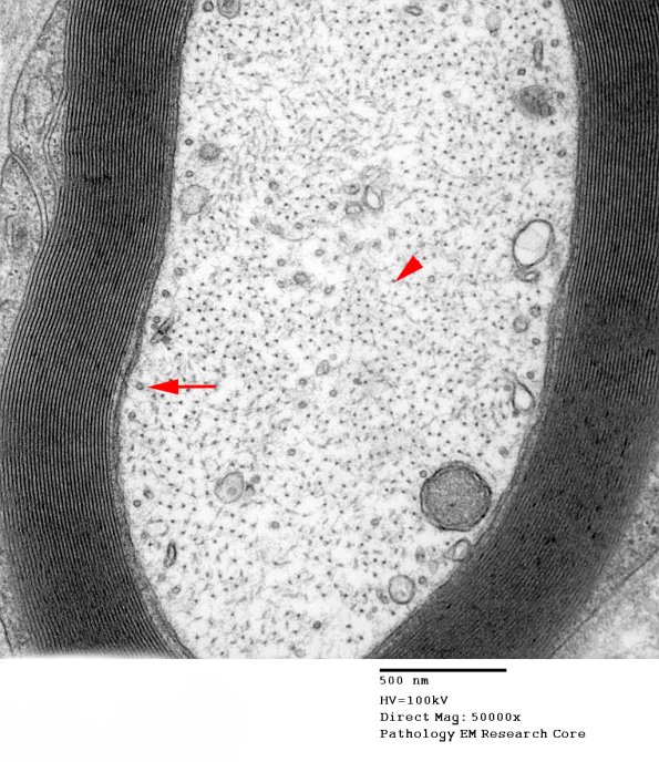 4A2 cytoskeleton (Case 4) 066 - Copy copy