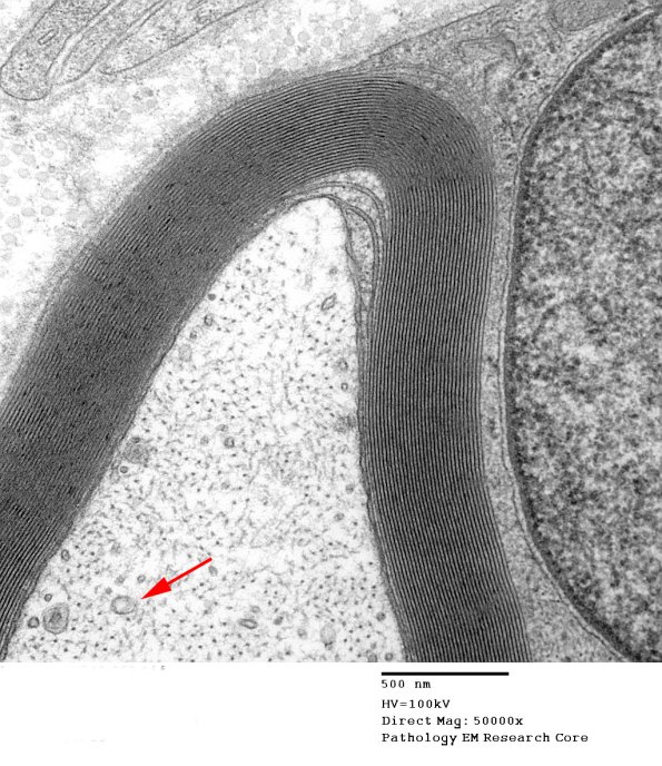 4A3 Normal axon (Case 4) 062 copy - Copy copy