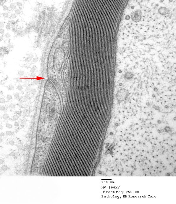 4A5 Normal axon, external mesaxon (Case 4) copy.jpg