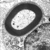 5A1 Axon, normal, PNS EM 1 (2) (Case 5) - Copy