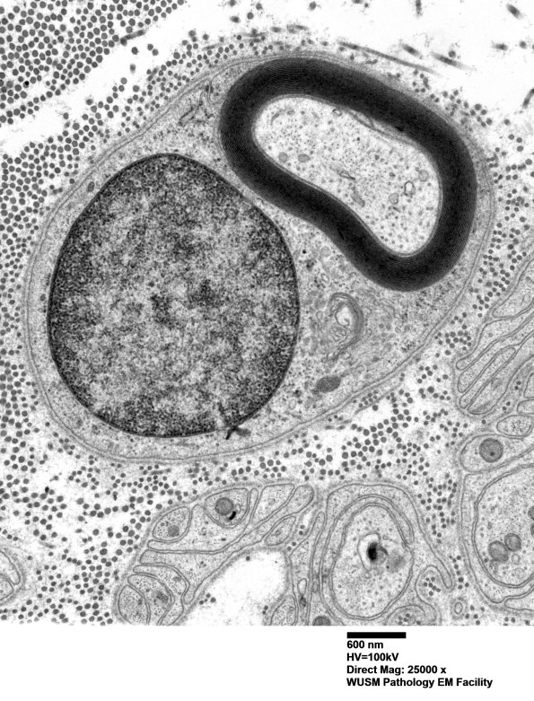 6A1 Normal axon (Case 6) 019 - Copy