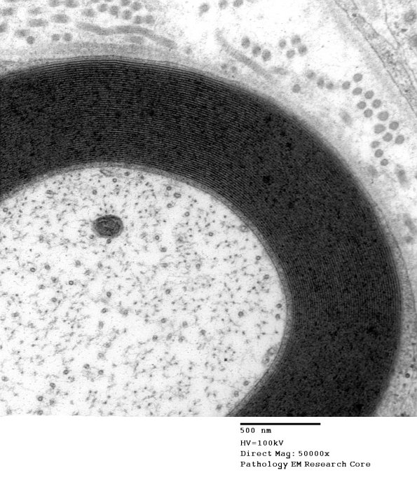 7A2 Axon, normal  (Case 7) EM 011 - Copy