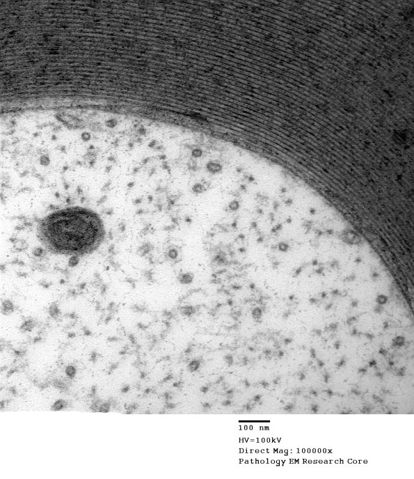 7A3 Axon, normal  (Case 7) EM 012 - Copy