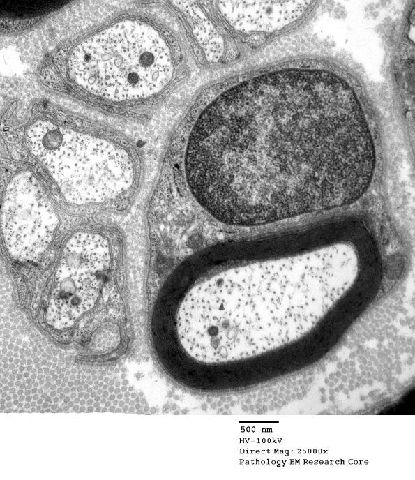 9A1 Normal Nerve (Case 9) new_039A - Copy