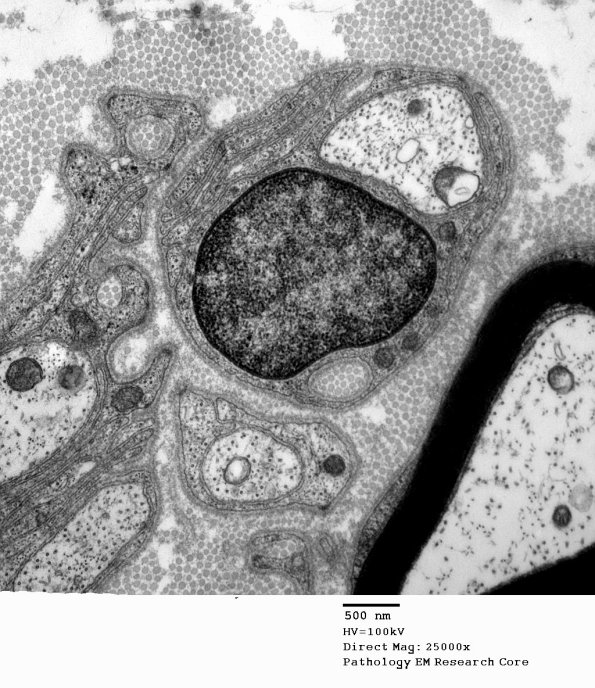 9A2 Normal Nerve (Case 9) new_040A - Copy