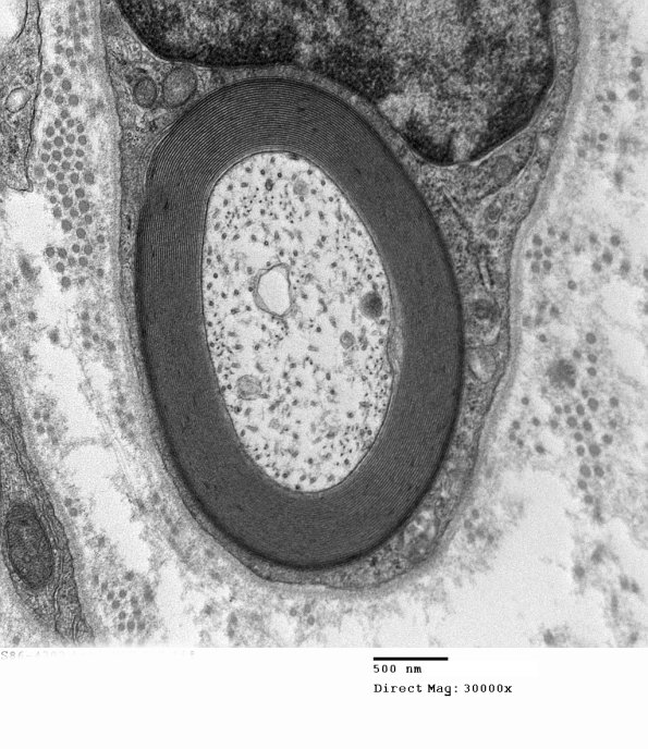 9A3 Normal axon (Case 9) 007 - Copy