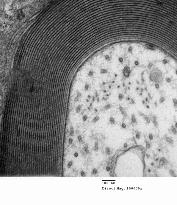 9A4 Normal axon (Case 9) 009 - Copy
